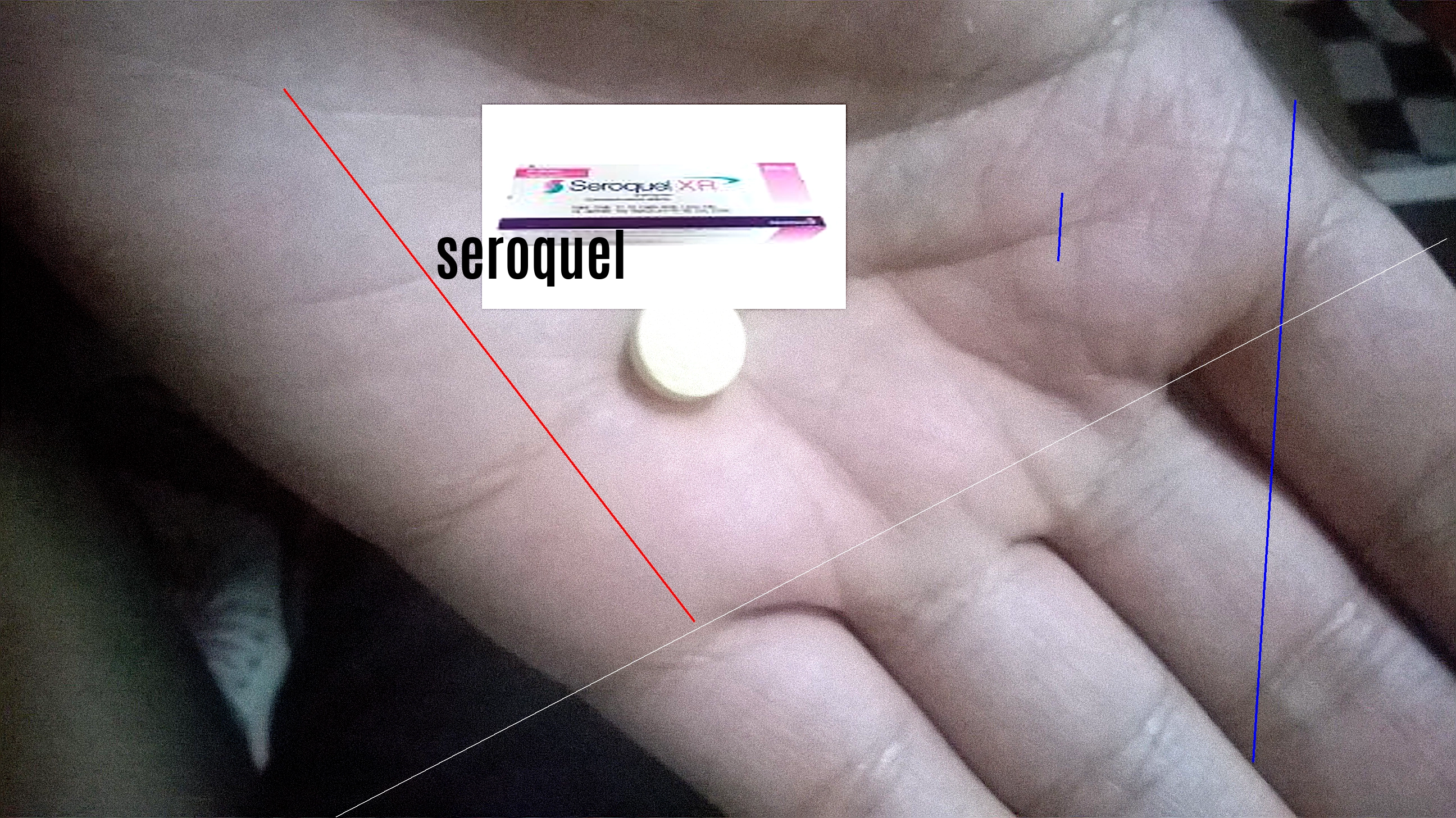 Seroquel 25 mg prix